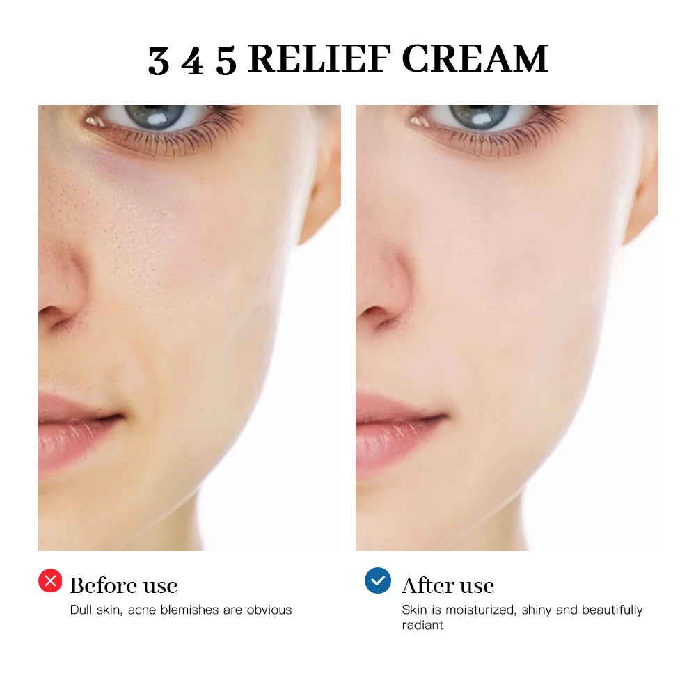 Blemish Recovery Barrier Relief Cream