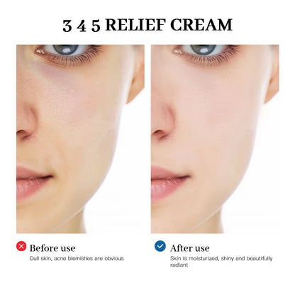 Blemish Recovery Barrier Relief Cream